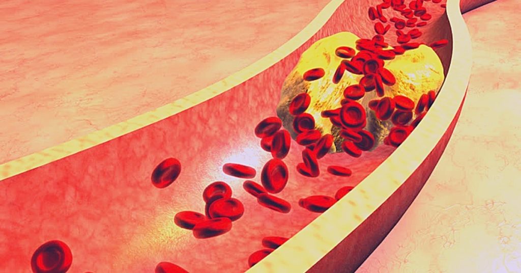 most-effective-essential-oils-for-cholesterol-how-to-use-easily