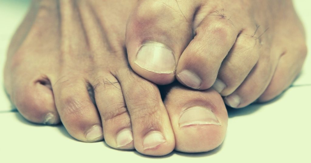 Essential Oils For Toenail Fungus - Top 8 + 3 Poweful Recipes To Try!